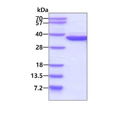 SDS-PAGE: Recombinant Human METTL1 His Protein [NBP1-50953]